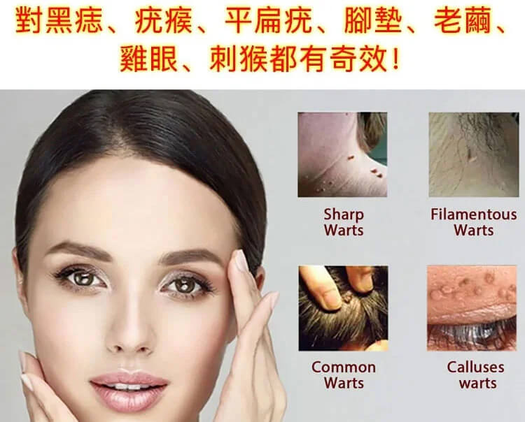 kinbt克疣液3.jpg
